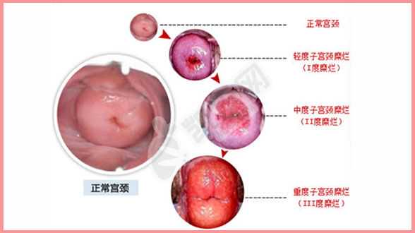 杭州捐卵者捐卵,郑州市妇幼保健院